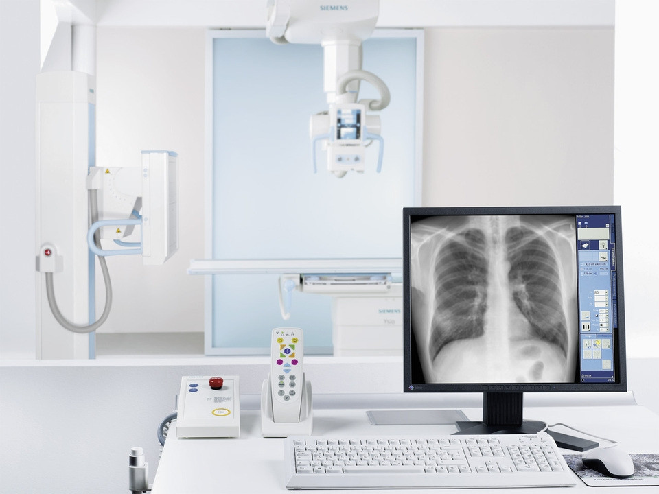 Цифровые рентгеновские аппараты: преимущества для врачей и пациентов